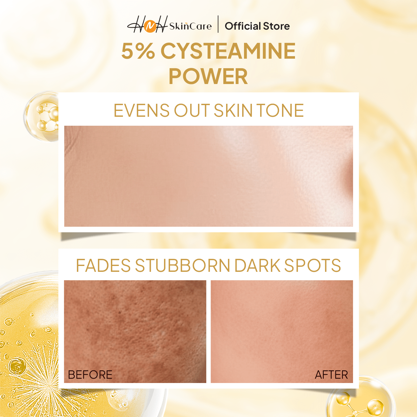 Signature by Kamila - Bundling Cysteamine Glow Booster Serum Solution & Cream Perawatan Pencerah Wajah untuk Menyamarkan Flek dan Mencerahkan - hnhskincare