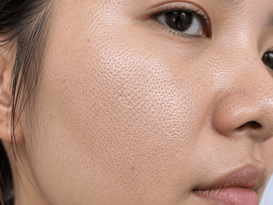 Pori-Pori Besar Susah Hilang? Ini Cara Bikin Kulit Halus Tanpa Makeup Tebal! - hnhskincare
