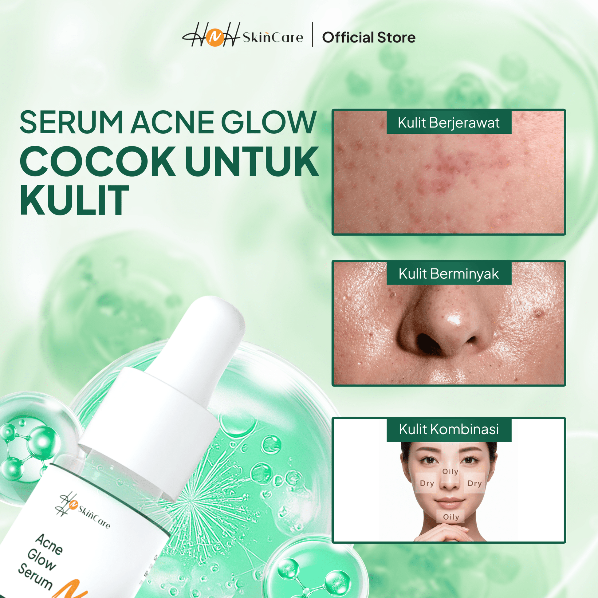 HNH Skincare - Acne Glow Serum - Serum Jerawat dan Bruntusan untuk Merawat Kulit Acne - Prone - hnhskincare