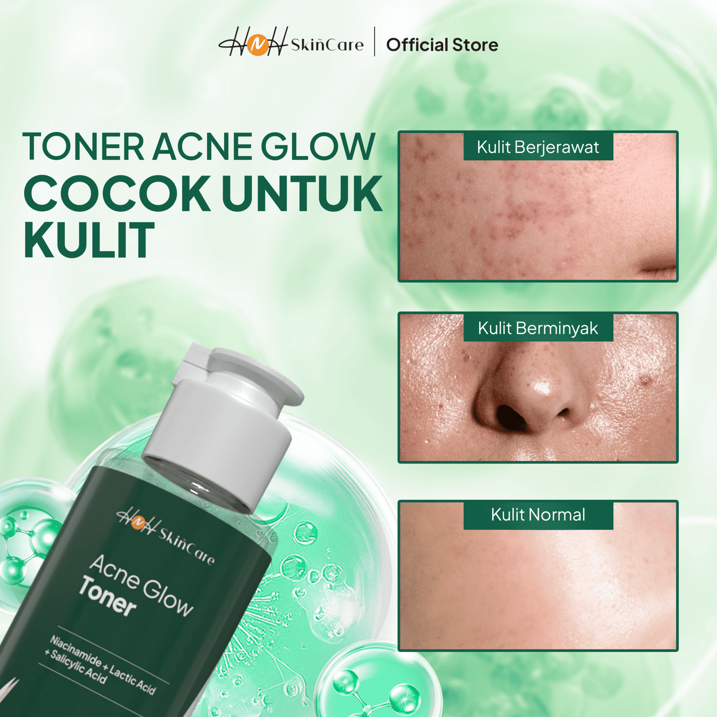 HNH Skincare - Acne Glow Toner - Exfoliating Toner untuk Kulit Berminyak, Berjerawat, dan Bruntusan - hnhskincare