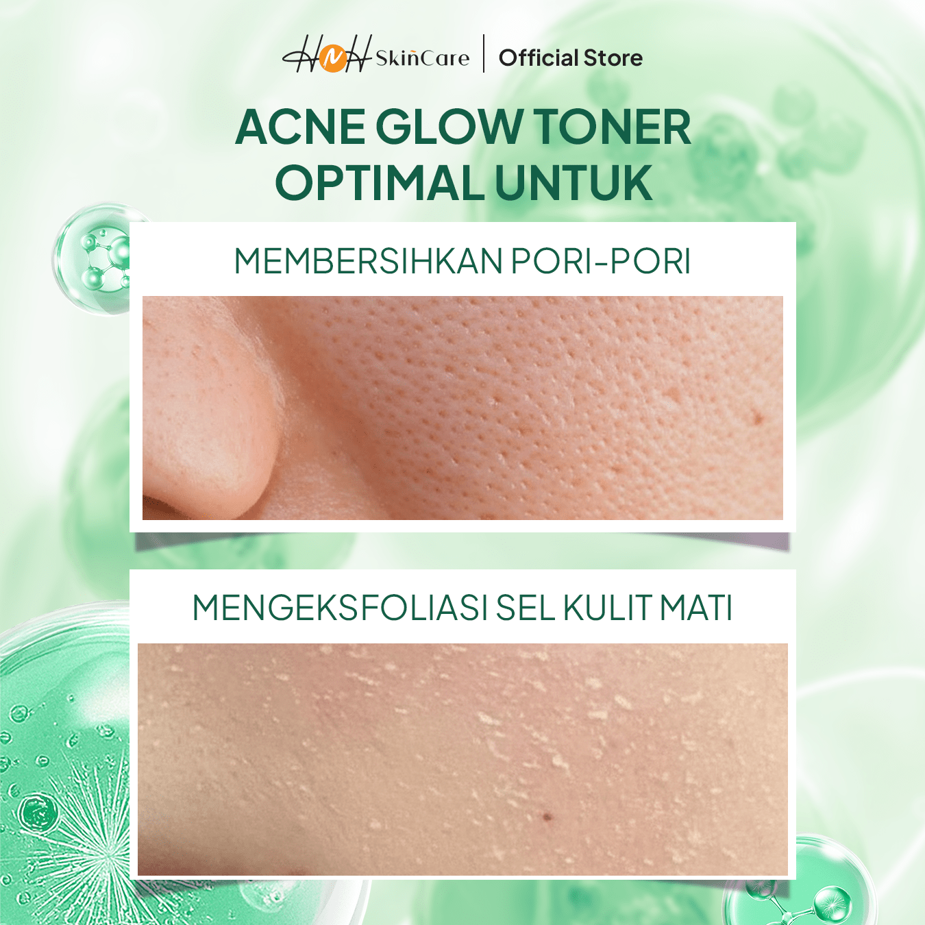 HNH Skincare - Acne Glow Toner - Exfoliating Toner untuk Kulit Berminyak, Berjerawat, dan Bruntusan - hnhskincare