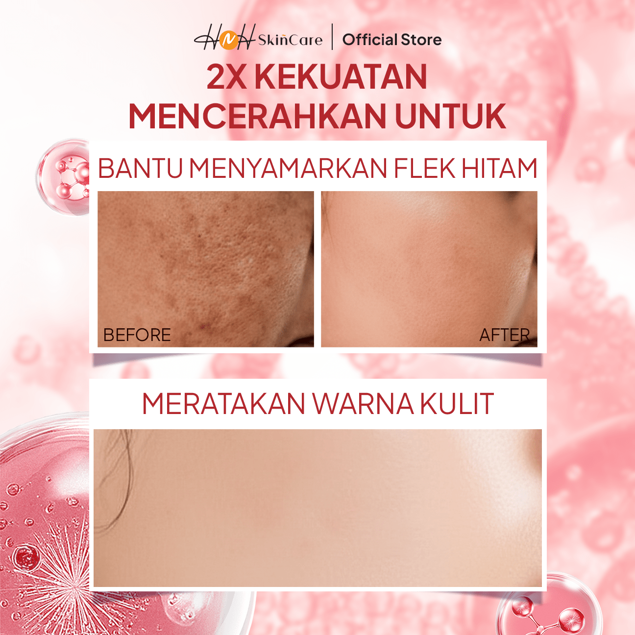 HNH Skincare - Advanced Lightening Intensive Serum - Brightening Serum Mencerahkan untuk Flek Hitam - hnhskincare
