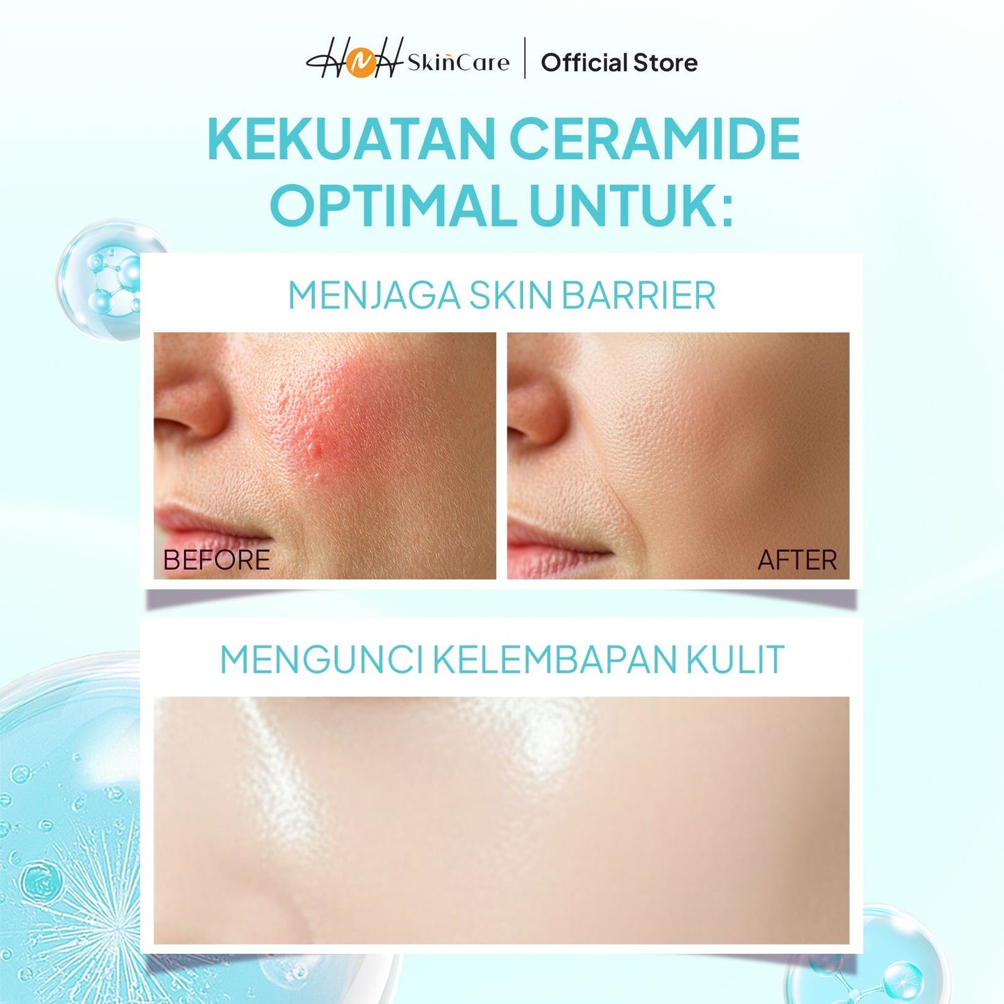 HNH Skincare - Brightening Ceramide - Hydra - Moisturizer Ceramide Pelembab Wajah untuk Skin Barrier - hnhskincare