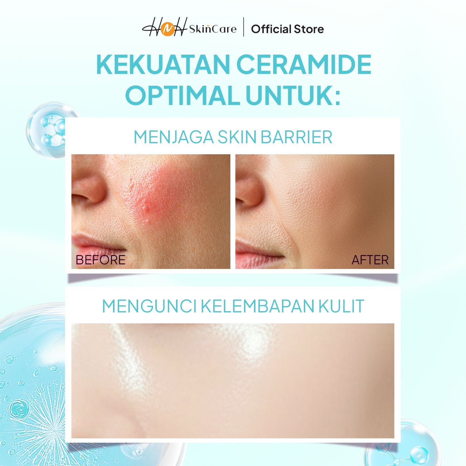 HNH Skincare - Brightening Ceramide - Hydra - Moisturizer Ceramide Pelembab Wajah untuk Skin Barrier - hnhskincare