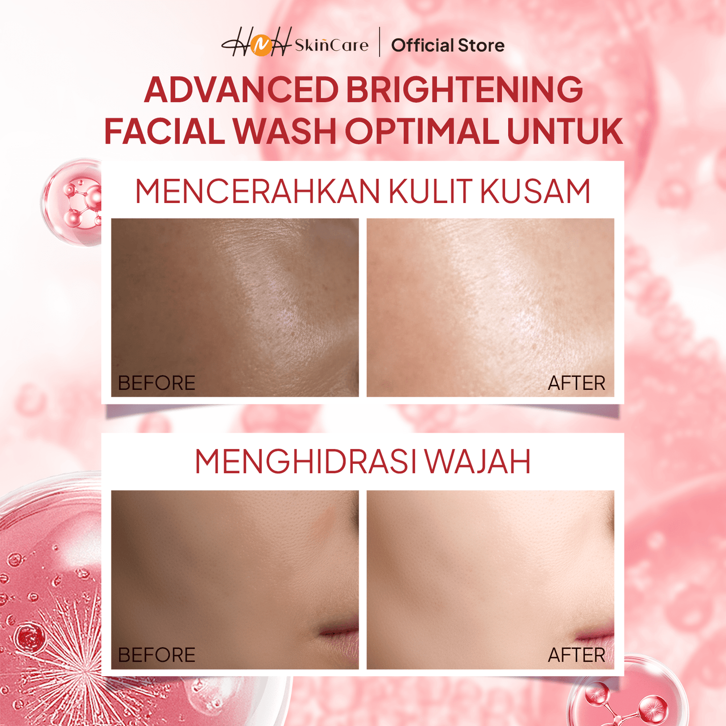 HNH Skincare - Bundling 2 Advanced Brightening Facial Wash - Sabun Cuci Muka Mencerahkan Wajah untuk Flek Hitam - hnhskincare