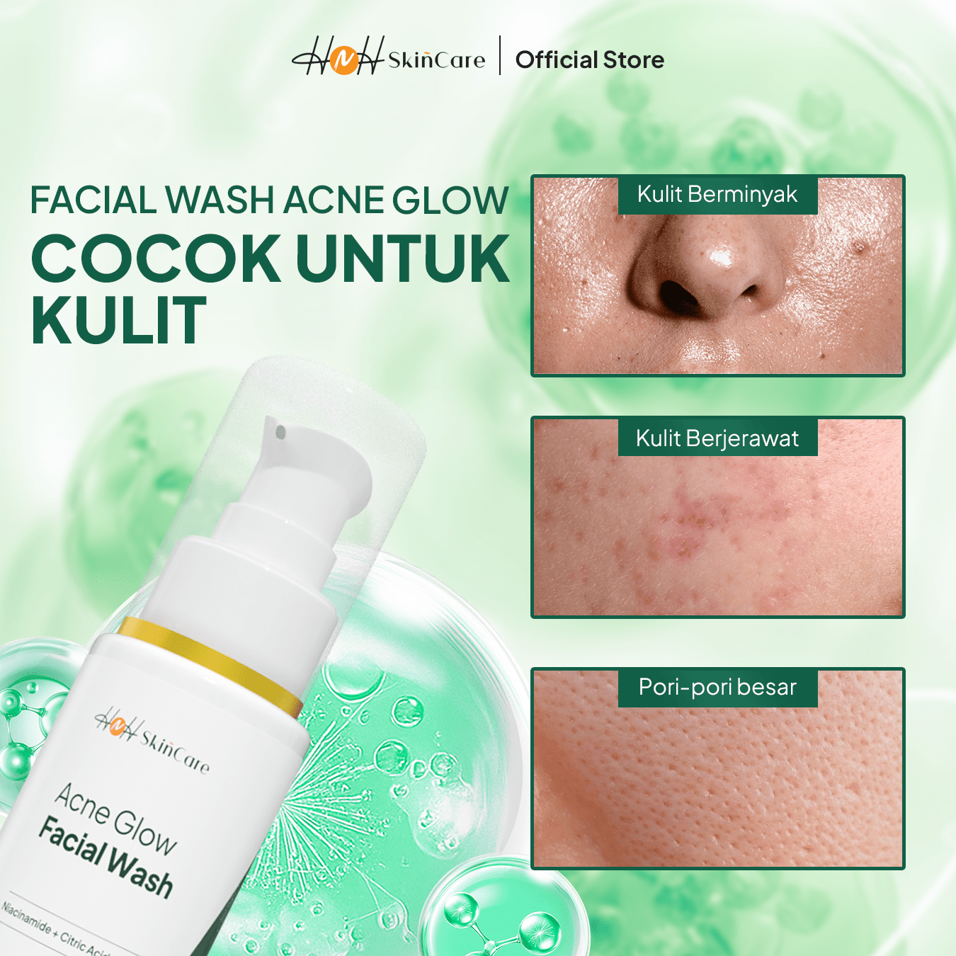 HNH Skincare - Bundling 2 Facial Wash Acne Glow - Sabun Cuci Muka Gentle untuk Kulit Berminyak & Berjerawat - hnhskincare