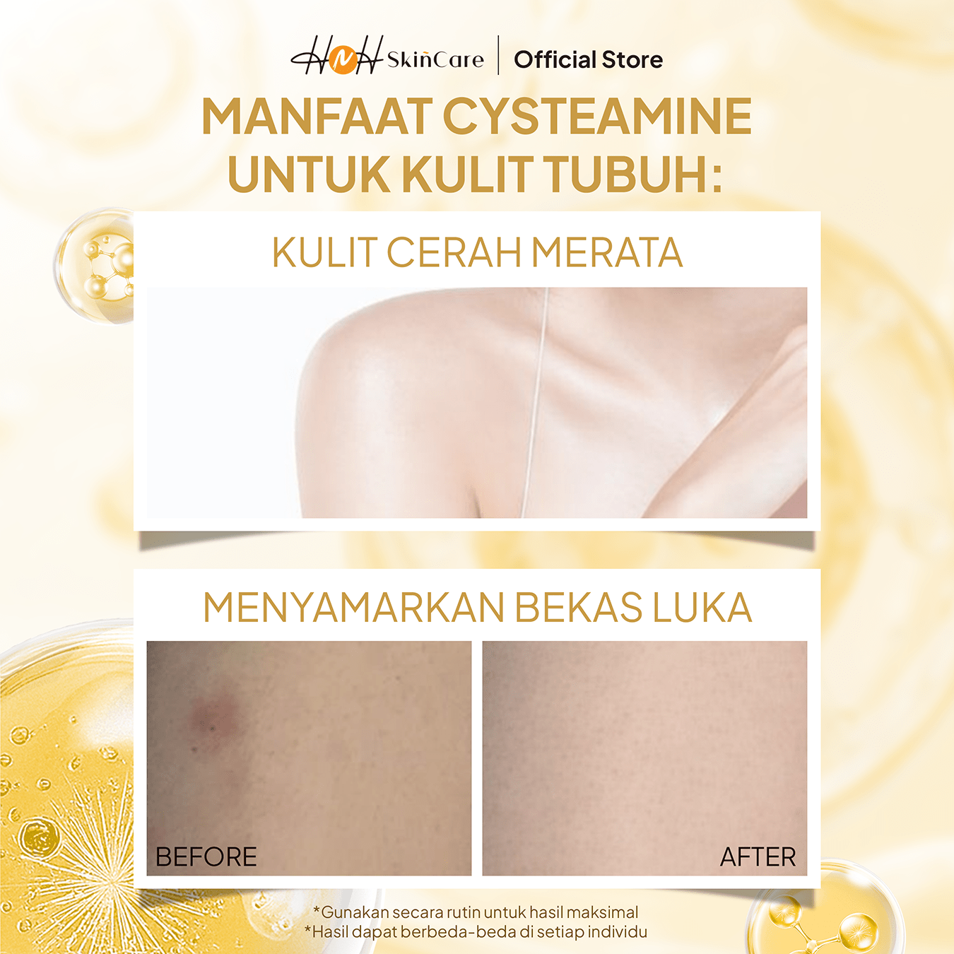 HNH Skincare - Cysteamine Body Lotion | HNH Skincare | Paket HB Dosting Pencerah Kulit | Cysteamine Intense Whitening Booster Body Serum & Lotion - hnhskincare