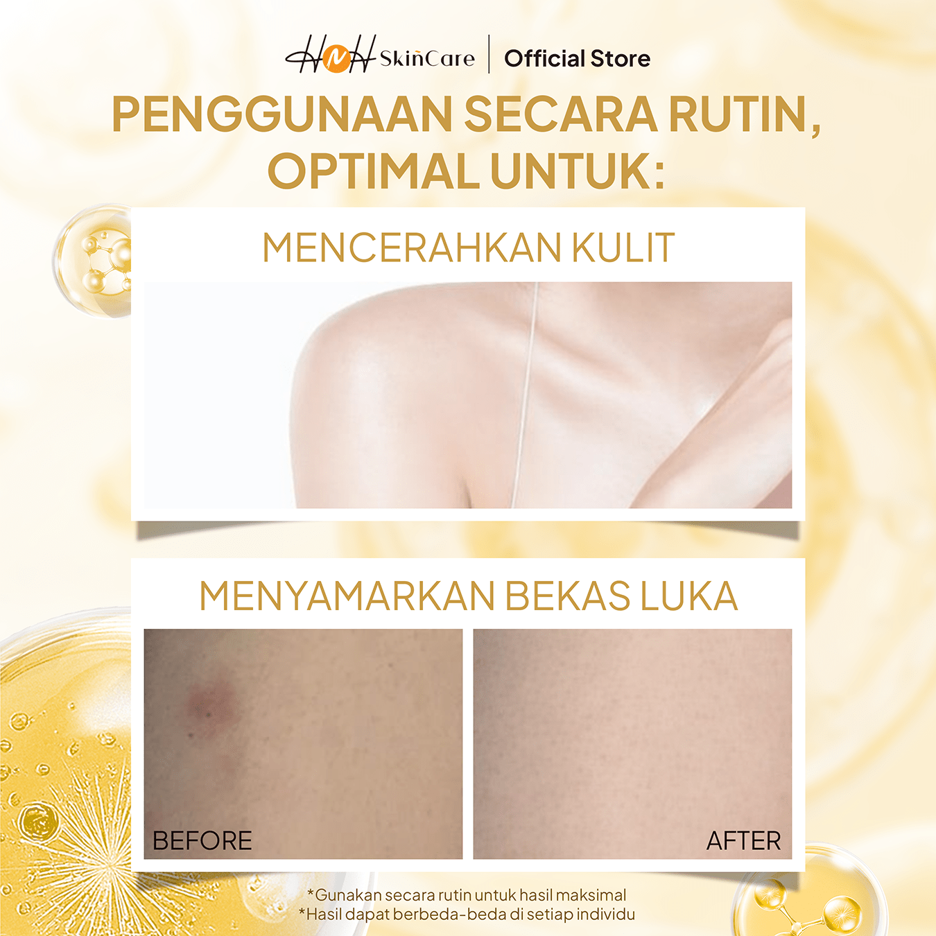 HNH Skincare - Cysteamine Body Serum | HNH Skincare | Paket HB Dosting Pencerah Kulit | Cysteamine Intense Whitening Booster Body Serum & Lotion - hnhskincare