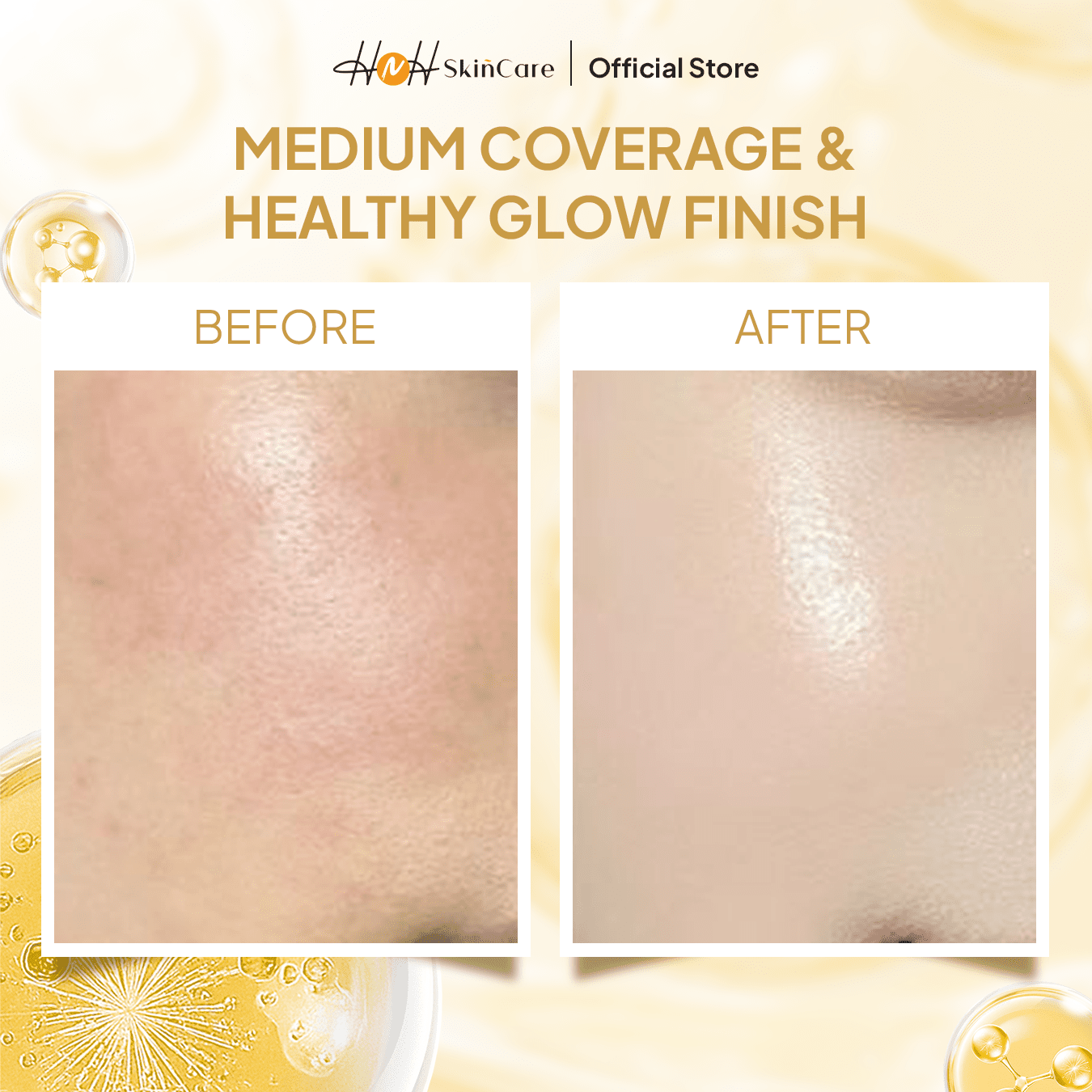 HNH Skincare - Glow Air Cushion - Flawless Glow Finish dengan Medium Coverage untuk Kulit Berjerawat - hnhskincare