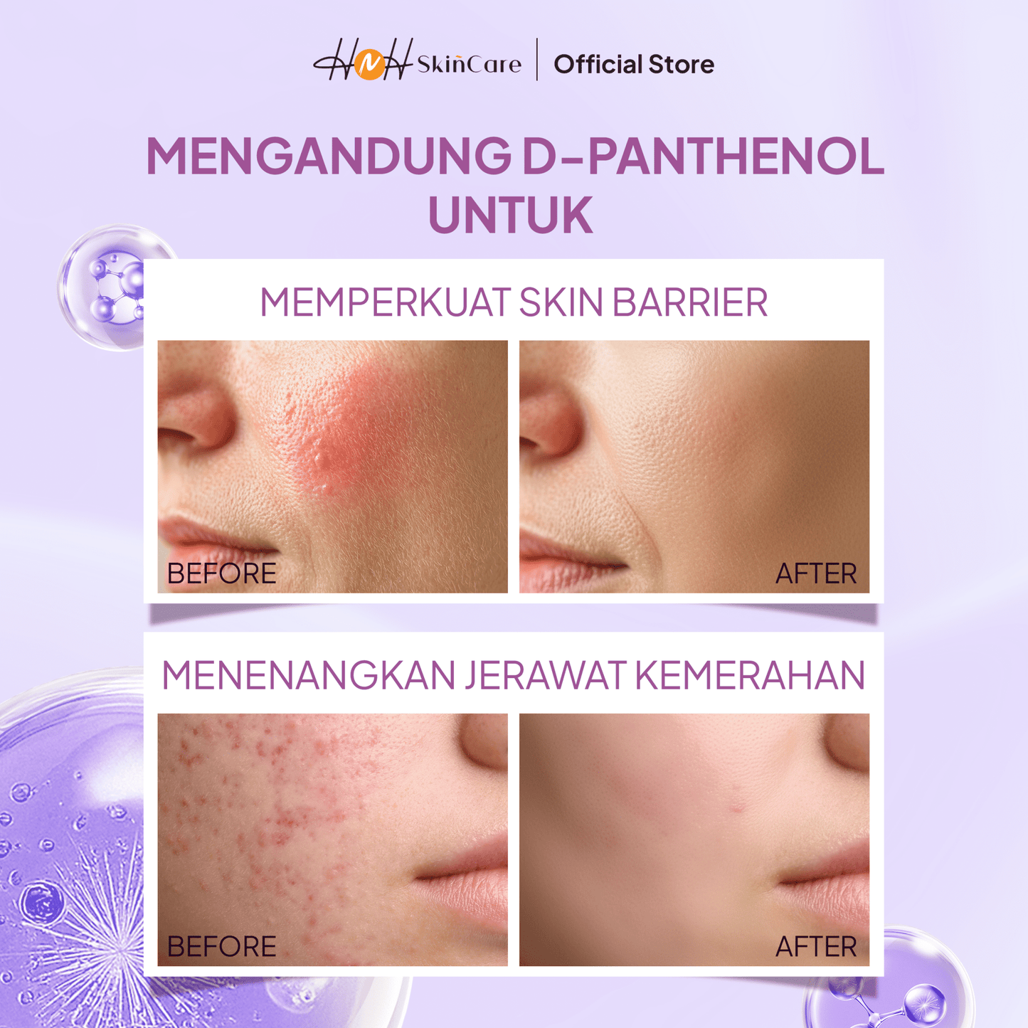HNH Skincare - Moisturizer Gel - Pelembap Wajah Gel Ringan untuk Semua Jenis Kulit - hnhskincare