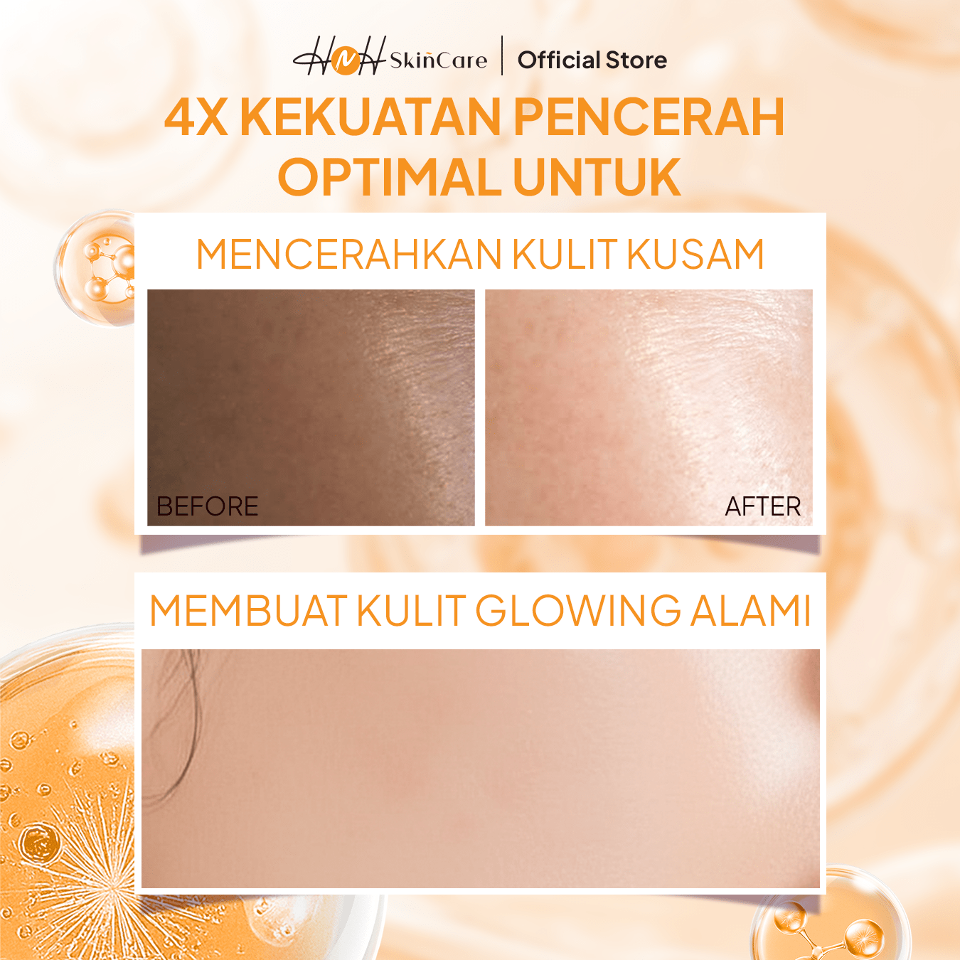 HNH Skincare - Pure White Liposom Whitening Serum - Serum Mencerahkan Wajah untuk Kulit Kusam - hnhskincare