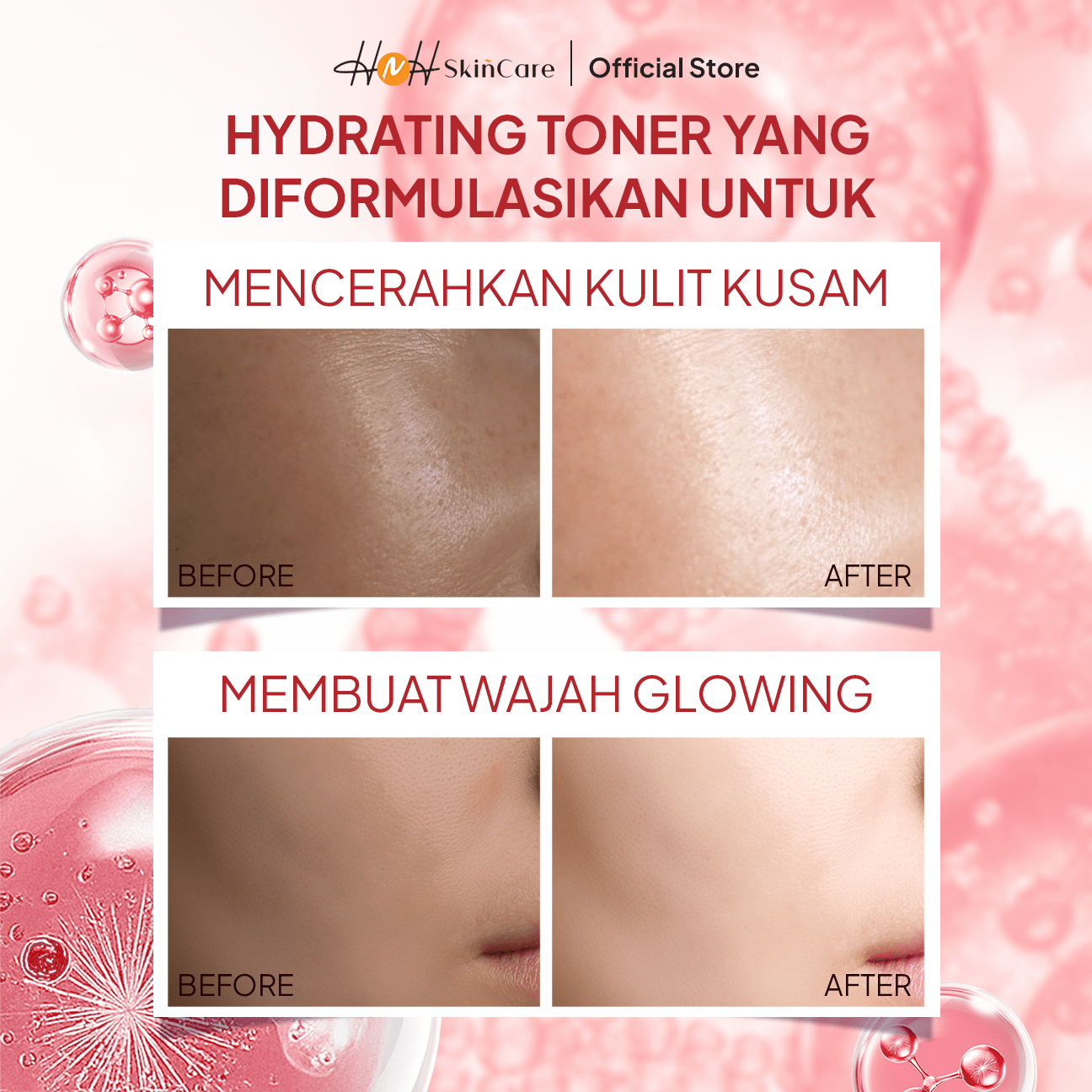 HNH Skincare - Purifying Glow Advanced Fresh Toner - Hydrating Toner untuk Mencerahkan Kulit Kusam - hnhskincare
