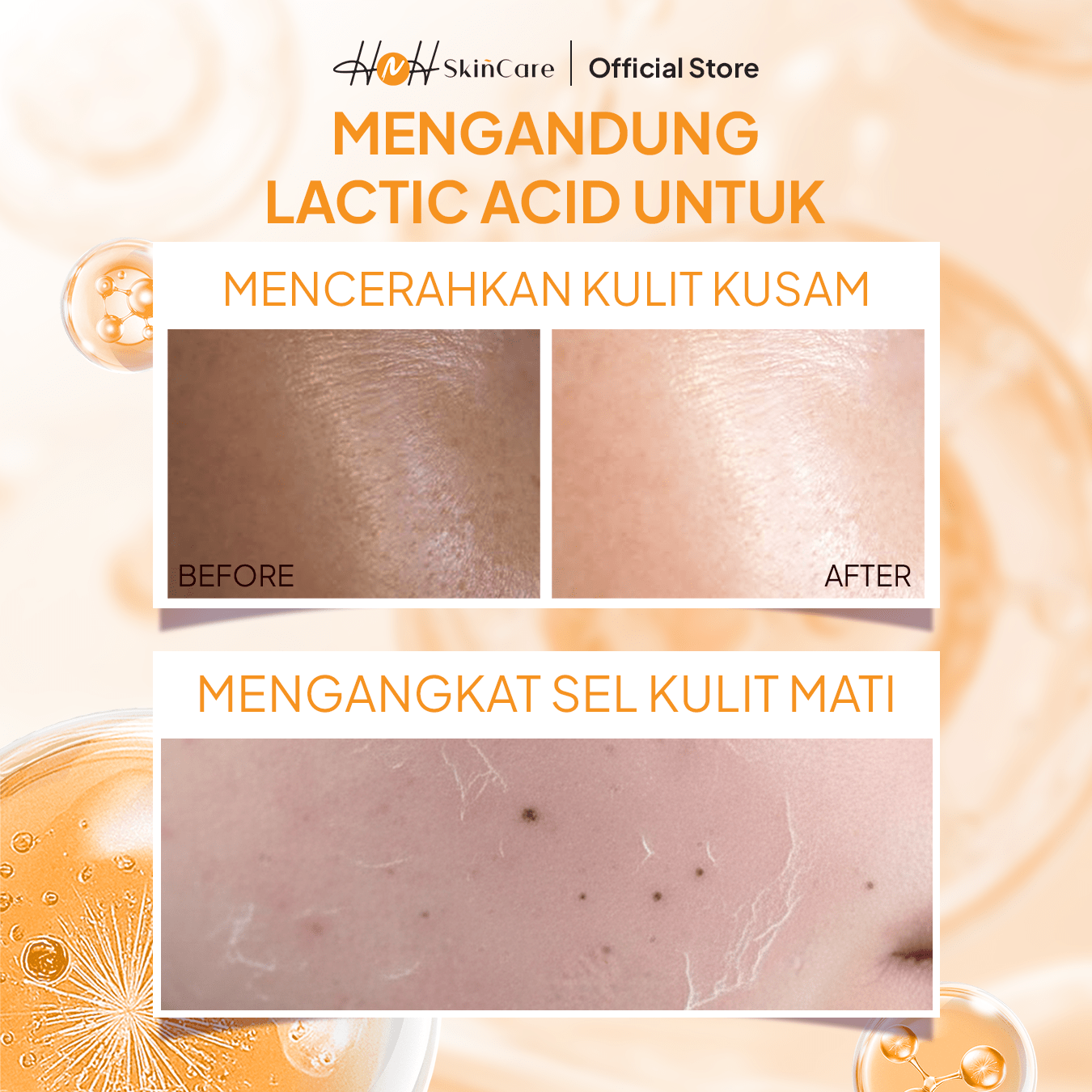 HNH Skincare - Toner Ultimate - Exfoliating Toner Mencerahkan untuk Kulit Normal dan Kulit Berminyak - hnhskincare