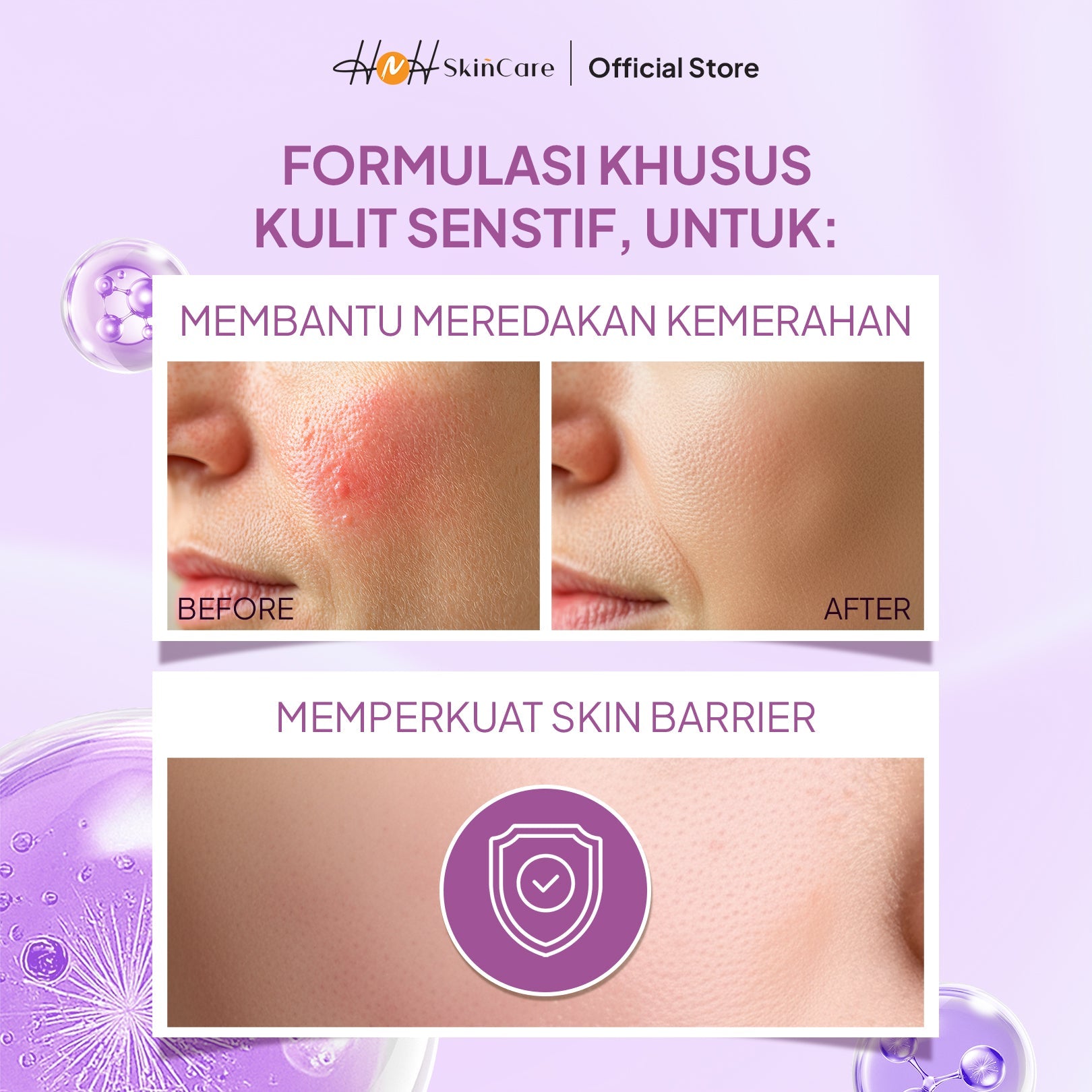 HNH Skincare - Ultramoisturizing Glow Gel - Moisturizer Pelembab Wajah untuk Kulit Kering Sensitif - hnhskincare
