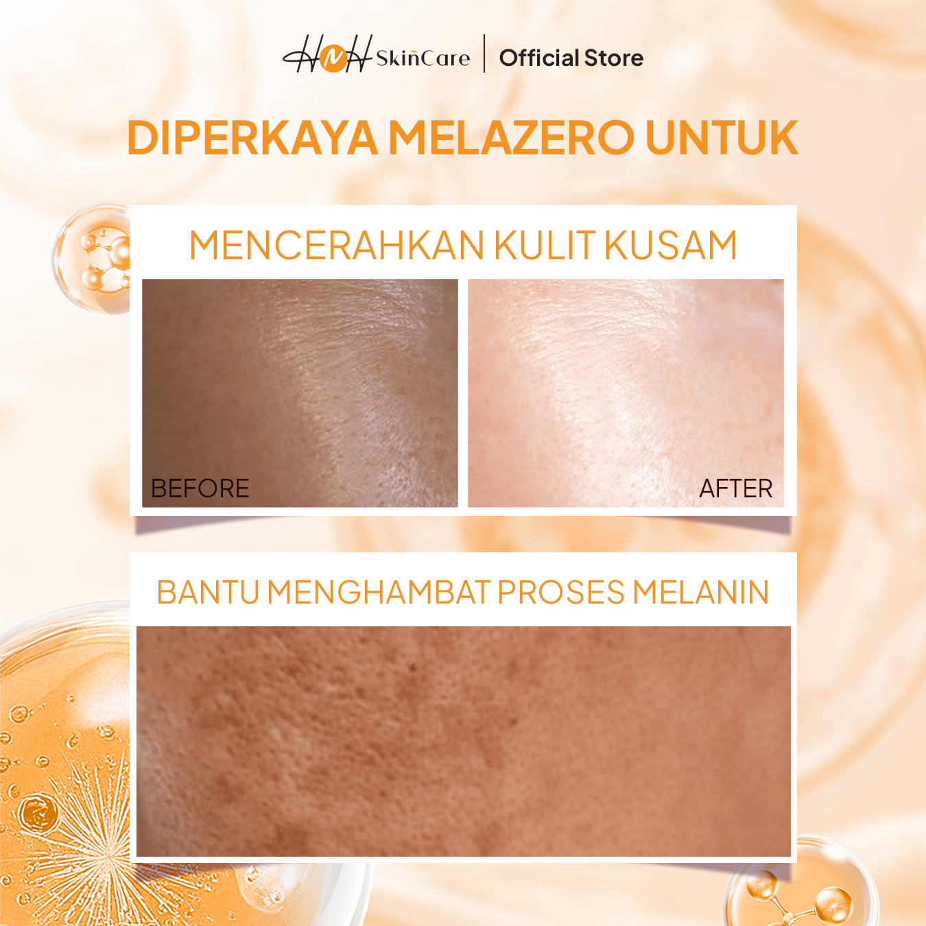 HNH Skincare - Whitening Melazero Night Cream - Krim Malam Glowing untuk Mencerahkan Kulit Kusam - hnhskincare