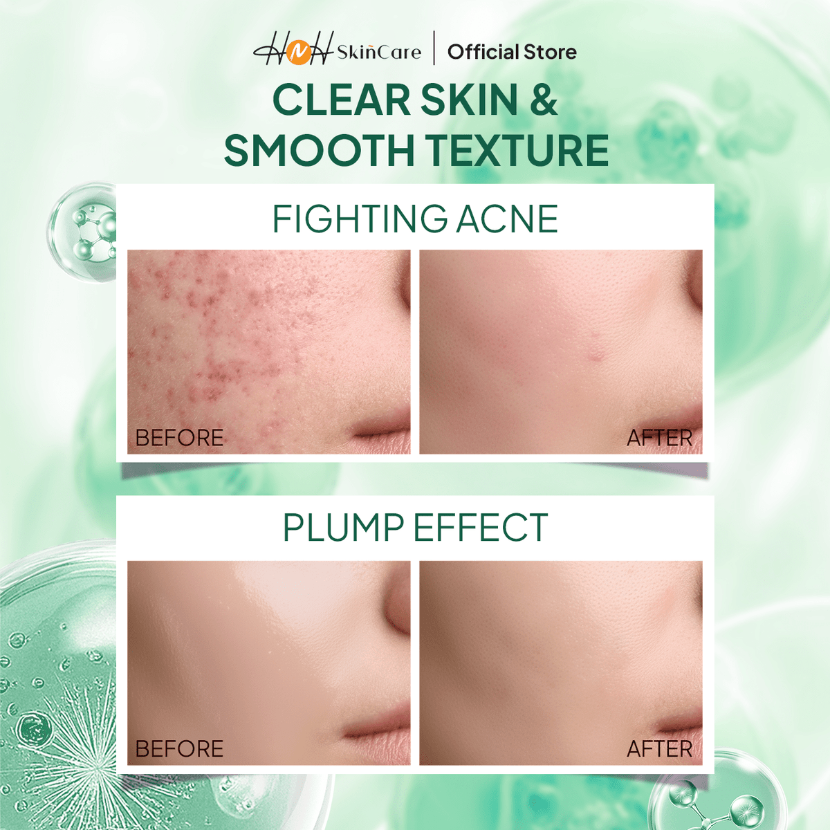 [PO] [NEW LAUNCH] Signature by Kamila - Bundling 2 DNA Salmon Galactocica Green Jelly Overnight Booster Moisturizer - hnhskincare