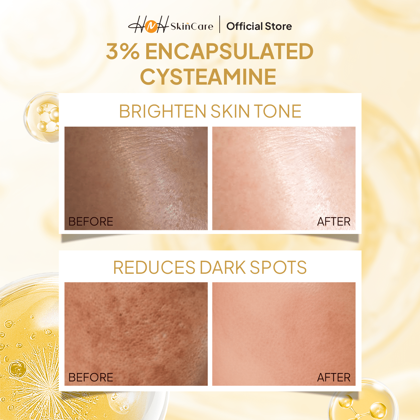 Signature by Kamila - Bundling Cysteamine Glow Booster Serum Solution & Cream Perawatan Pencerah Wajah untuk Menyamarkan Flek dan Mencerahkan - hnhskincare