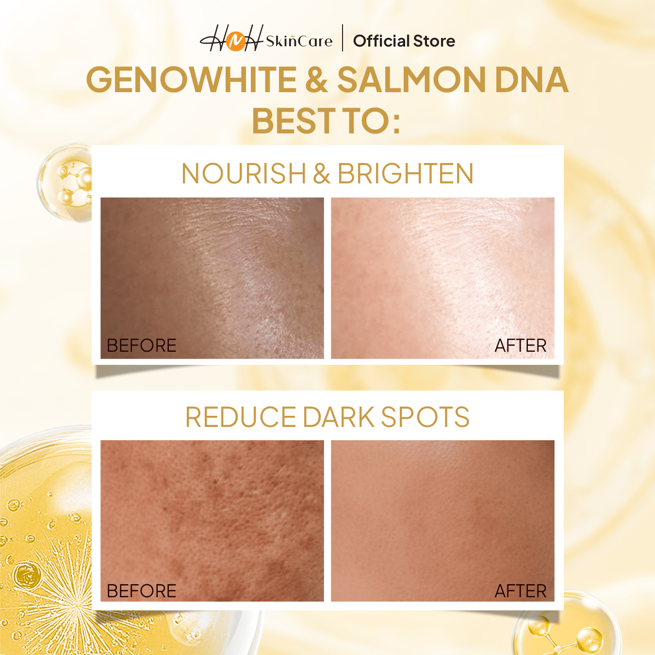 Signature by Kamila - Salmon DNA Whitening Serum - Serum Mencerahkan Wajah / Menyamarkan Flek Hitam - hnhskincare